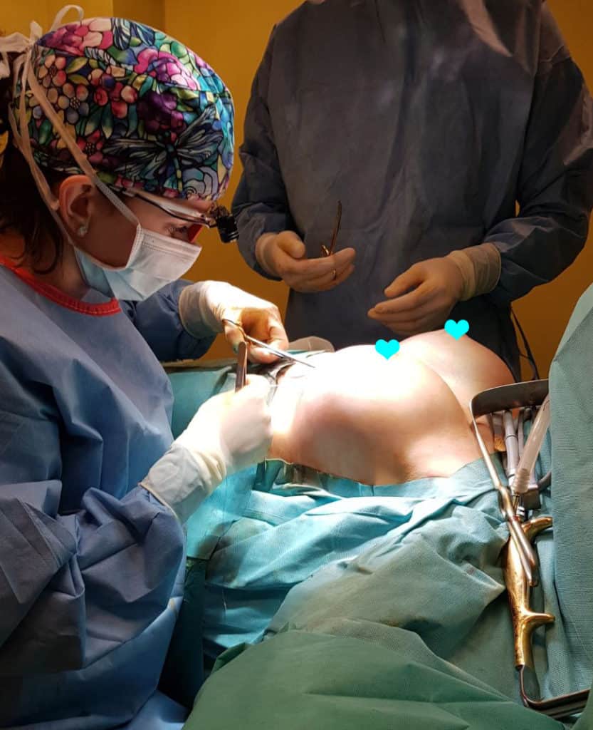 Dr. Daniela Diveica in operatia de implant mamar
